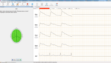 Начало мониторинга