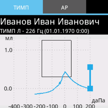 Тимпанометрия